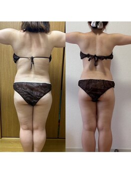 ヨサパーク レイ 等々力(YOSA PARK Ray)/お客様の変化　全身水素コース