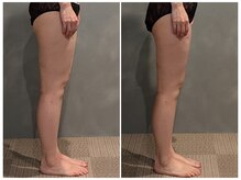 ツーアップ(2up)/太もも厚み1回