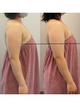 ロココ 豊田店(Rococo)/ビフォーアフター