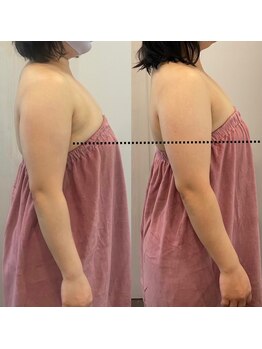 ロココ 豊田店(Rococo)/ビフォーアフター