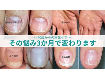 キラリネイル(KIRARINAIL)