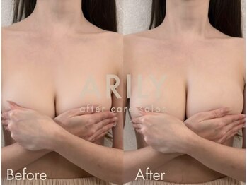 アリリィ(ARILY)/ARILY after care salon
