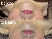 ディアーム 光明池店(Diarm)/韓国式脂肪分解レッドショット