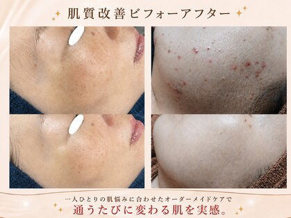 サンテ(Sante)の写真