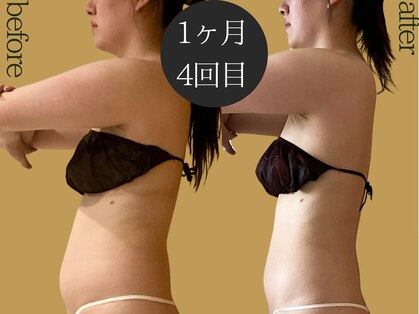 マルレ(MARLE)の写真
