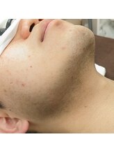 ブリーゼ湘南/ビフォー