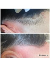 マイレ 銀座(MAILE)/うなじ