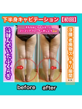 ビューティ ウィッチ(Beauty Witch)/