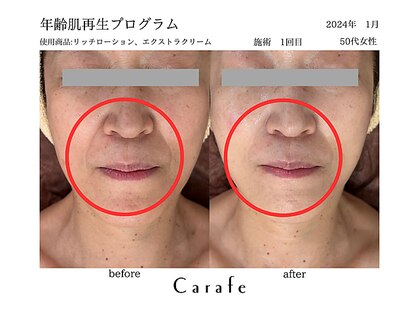 カラフ(Carafe)の写真