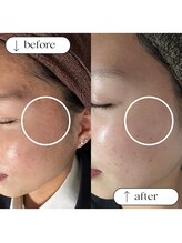 ケースタイル(k.style)/肌質改善