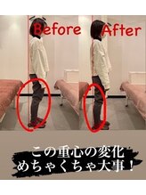 ジェイペック鍼灸整骨院/全身矯正【肩こり・腰痛に】