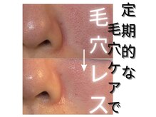 ルアン 都賀(Ruang)の雰囲気（人気No1毛穴ケア！ハイドラフェイシャルで毛穴レスな肌へ導く！）