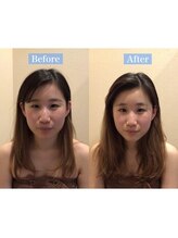 アジール 長岡リバーサイド千秋店(agir)/Before/After画像
