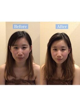 アジール 長岡リバーサイド千秋店(agir)/Before/After画像