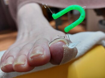 爪切り屋 足楽/日々挑戦★オルトグリップ