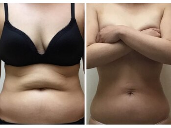 プリンセス バイ セイフティプリンセス 長野店(PRINCESS)/上半身痩せ