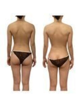 ベンザイ 梅田店(BENZAI)/肩甲骨、背中の張り