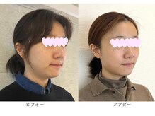 ベルメイク(BELLE MAKE)/美整コルギ☆ビフォーアフター横
