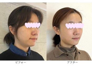 ベルメイク(BELLE MAKE)/美整コルギ☆ビフォーアフター横