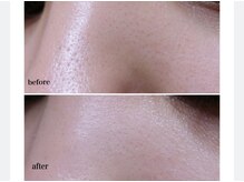 アクティブエイジング/【エンビロン】ポリッシング