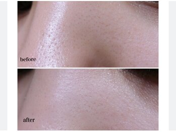 アクティブエイジング/【エンビロン】ポリッシング