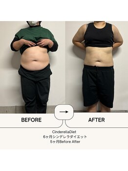 オーシャン整骨院(OCEAN整骨院)/6ヶ月コース