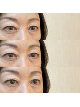 シアミス(SIAMIHS)/まつげパーマ