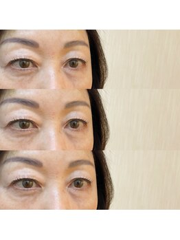 シアミス(SIAMIHS)/まつげパーマ