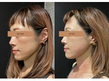 メグムサロン(Megumu Salon)/小顔矯正/リンパマッサージ/頭痛