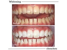 シュシュ(chouchou)の雰囲気（医療機関提携のジェルを是非体験してみてください◎）