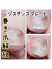 フット【巻き爪補正】1本《ホームケア付き》￥6800