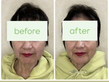 わかくさ鍼灸整体院/