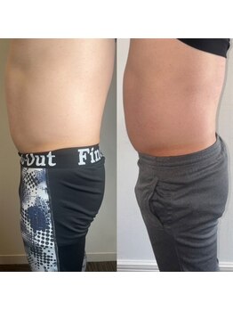 プルメリア(Plumeria)/コース終了間際の成果3