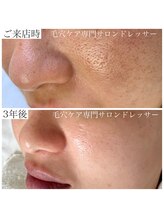 ドレッサー(Dresser)/根本改善で褒められ肌へと