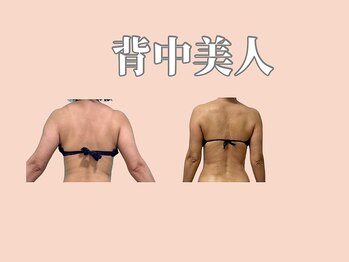 ルアナ(Luana.)/40代からの背中美人