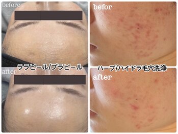 ナチュール(nature)