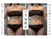 さとう美容整体 町田店/整体+全身ハイパーナイフEX　5回