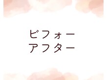 幸せ甦顔/ビフォーアフター写真