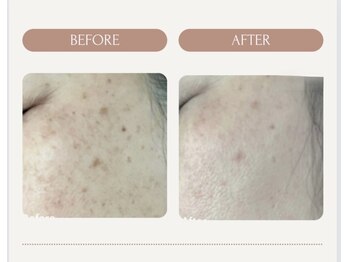 マオ(mao)/☆6回Before→after☆