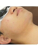 ブリーゼ湘南/アフター