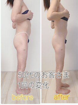 癒 ザ ビューティ(癒 the beauty)/50代のお客さまビフォーアフター