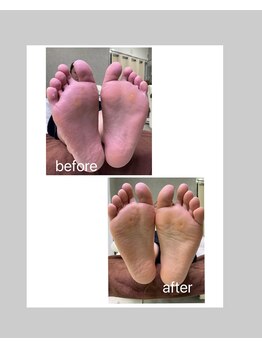 ハニーエイク(Haney89)/スペシャルフットケア☆