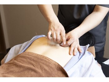 ラックス鍼灸 整体院(Lachs鍼灸 整体院)/鍼施術