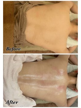 メナードフェイシャルサロン 片町店/背中美人へ