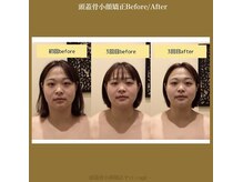 アジール 長岡リバーサイド千秋店(agir)/Before/After画像