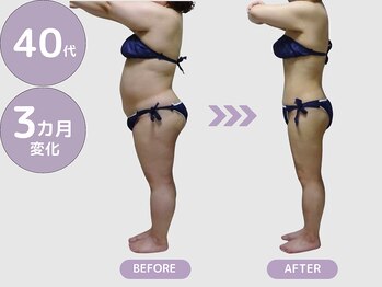 ビップ 赤坂店(Bipp!)/40代・3カ月の変化