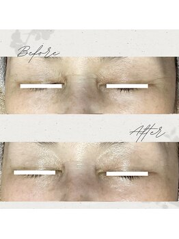 ネリネ(Nerine)/生プラセンタフェイシャル