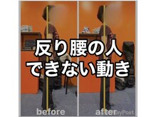 カワル整体 上通り院/反り腰の人ができない動き