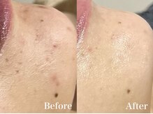 マシェ バイ マユ(Mache by Mayu)/残ってしまっても諦めないで！