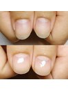 自爪でちゅるんネイル♪美爪育成